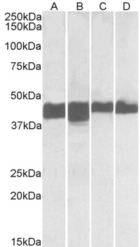 CKM/Creatine Kinase MM Antibody