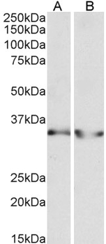 LDHB/Lactate Dehydrogenase B Antibody