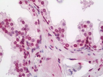 ELF5 Antibody