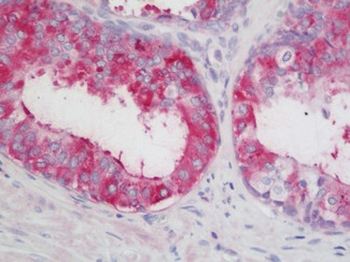 LOXL2 Antibody