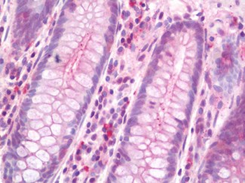 HLA-G Antibody