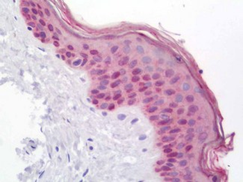 MEIS1 Antibody