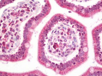 KRAS Antibody