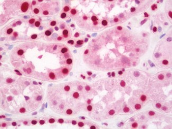 AATF Antibody