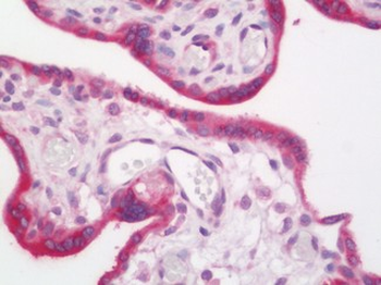 MAGEA3 Antibody