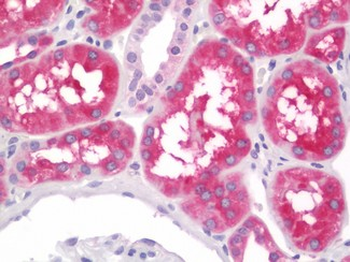 ALDH1L1 Antibody