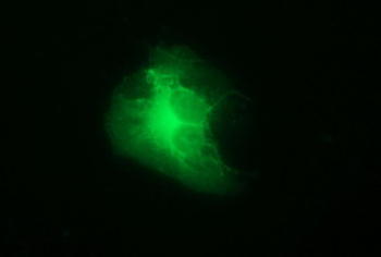 TH/Tyrosine Hydroxylase Antibody