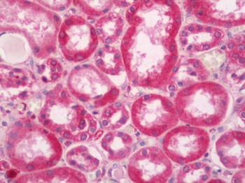 DNAJC13 Antibody