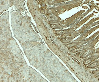SLC29A3/ENT3 Antibody