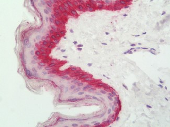 CDO1/Cysteine Dioxygenase Antibody