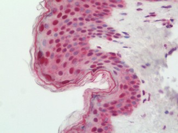BATF3 Antibody