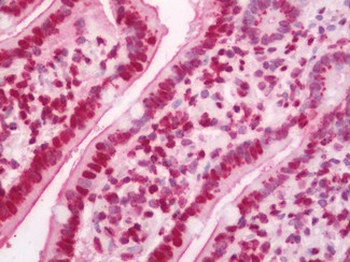 GBP2 Antibody