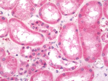 MAP1S Antibody