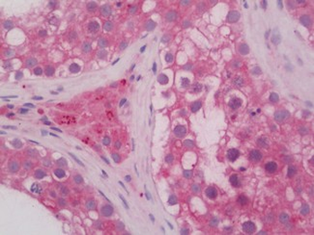 RAB5A/RAB5 Antibody