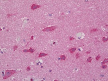 NRP1/Neuropilin 1 Antibody