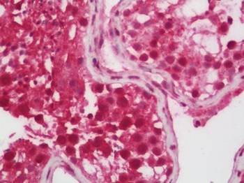 SETD2 Antibody