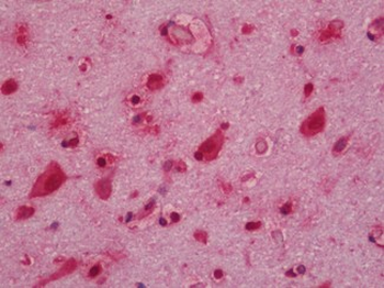 BF1/FOXG1 Antibody