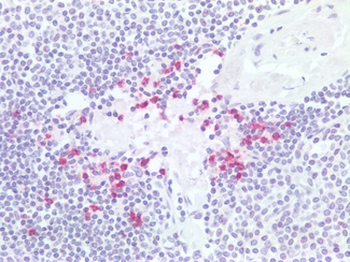 PDCD1/CD279/PD-1 Antibody