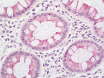 SCN4B Antibody