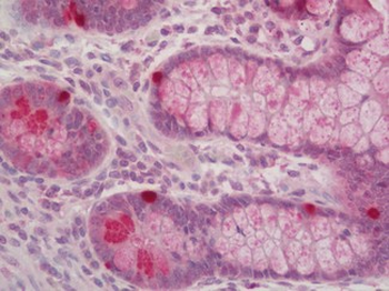 ROR1 Antibody