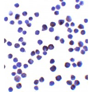 IL11 Antibody