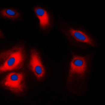HSPA5/GRP78/BiP Antibody