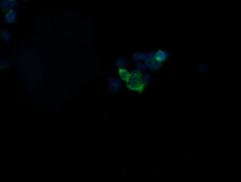 GBAS Antibody
