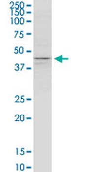 KCNJ5/Kir3.4/GIRK4 Antibody