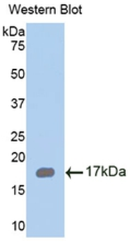 RARRES2/Chemerin Antibody