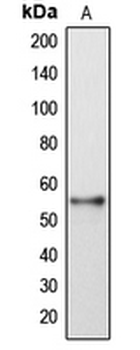 DFNA5 Antibody