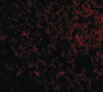 IER3/IEX-1 Antibody