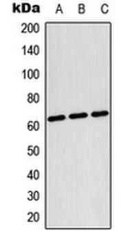TESK2 Antibody