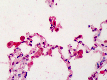 IL22RA1/IL22R Antibody