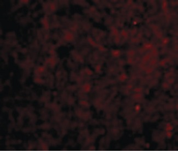 IRAK3/IRAKM/IRAK-M Antibody