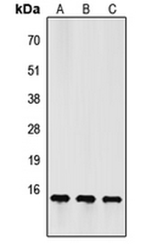 FSHB/FSH Beta Antibody