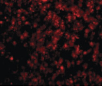 LIPE/HSL Antibody