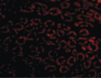 NPHS1/Nephrin Antibody