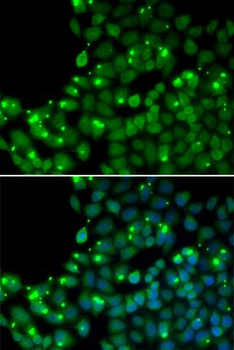MGMT Antibody