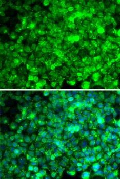 ADIPOR1/Adiponectin Receptor 1 Antibody