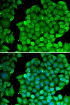 CCND2/Cyclin D2 Antibody