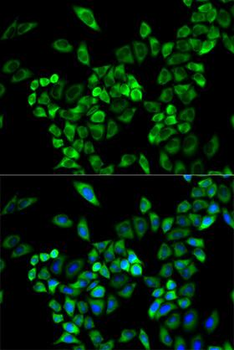 AOC3/VAP-1 Antibody