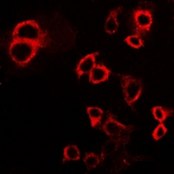 CD119/IFNGR1 Antibody