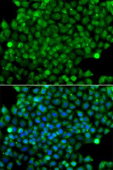 CFHR3/CFHL3 Antibody