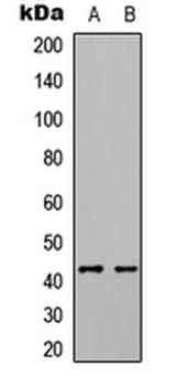 EPHX4/Epoxide Hydrolase 4 Antibody