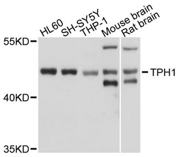 TPH1/Tryptophan Hydroxylase Antibody