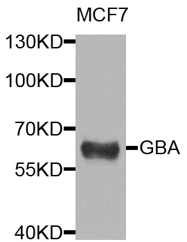 GBA/Glucosidase Beta Acid Antibody