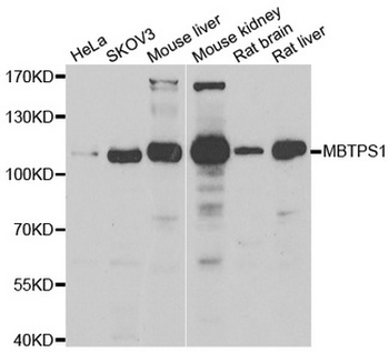 MBTPS1/S1P Antibody