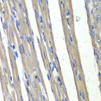 DDX/AKR1C3 Antibody