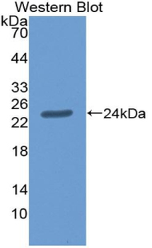 AGRN/Agrin Antibody