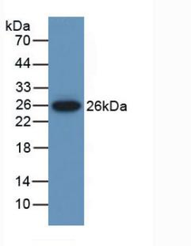 MUSK Antibody